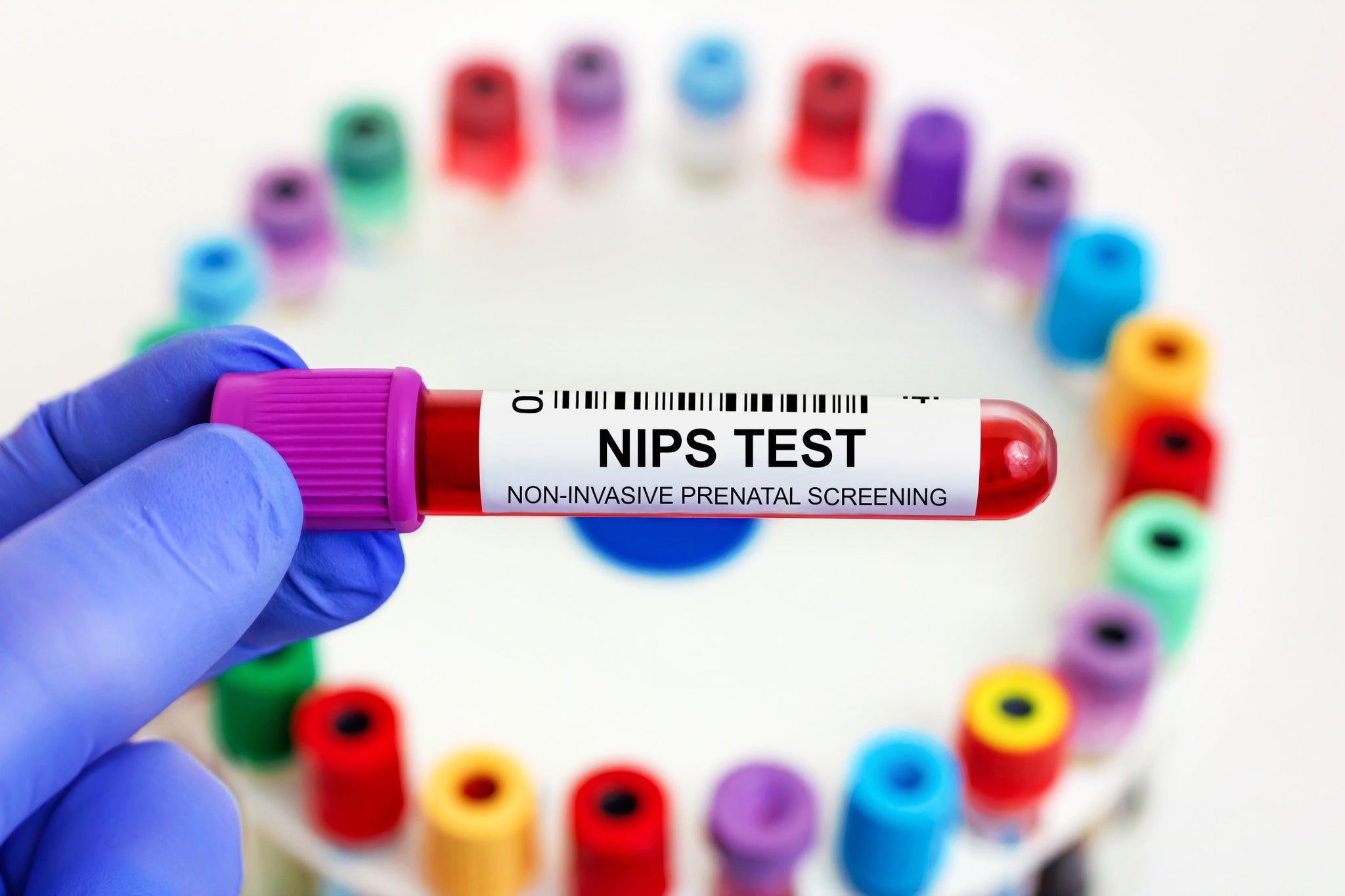 A vial of blood collected to perform the Juno Hazel non-invasive prenatal test