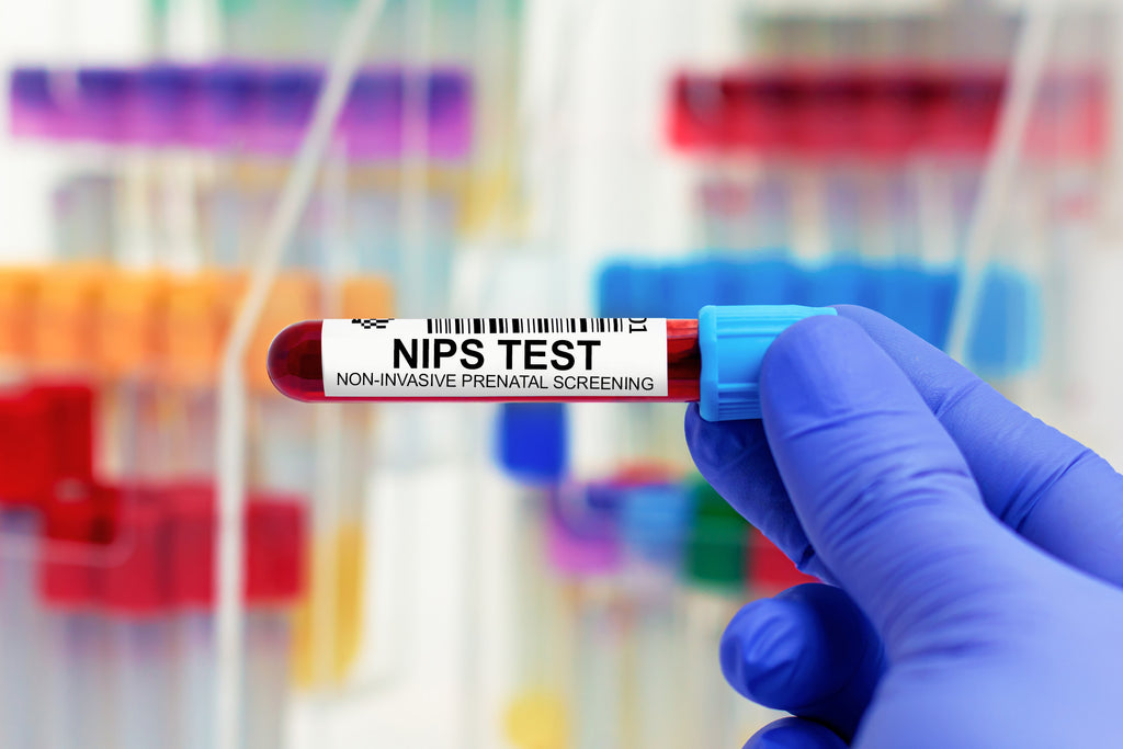A vial of blood to perform noninvasive prenatal genetic test for pregnant women