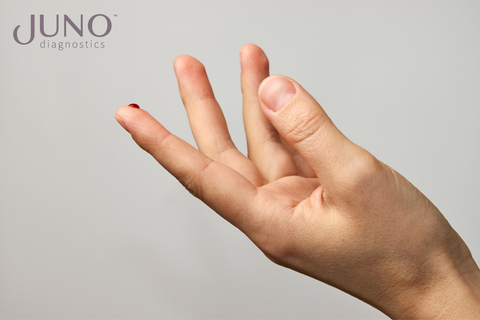 NIPS can be done as early as 10 weeks after your last menstrual period and only involves a quick blood draw with a needle and syringe, so it’s completely safe and poses no risk to you or the pregnancy.