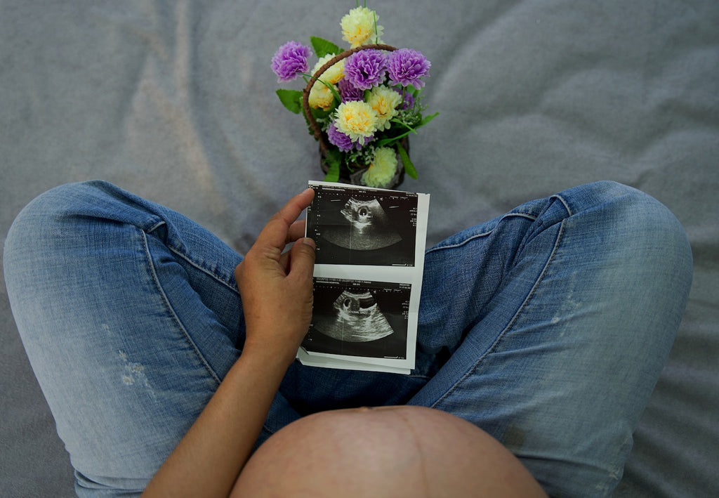 A pregnant woman reviews her pregnancy ultrasound.